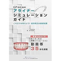 Amazon.co.jp: アライナー矯正のリカバリーテクニック : 槇 宏太郎, 槇