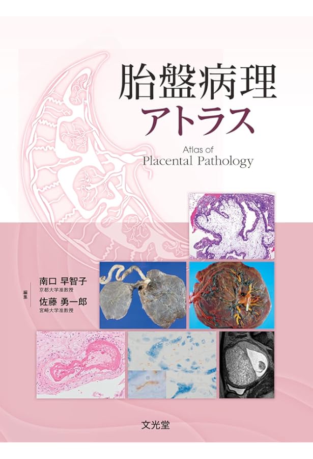 基礎と臨床の両側面からみた 胎盤学 | 日本胎盤学会 |本 | 通販 | Amazon