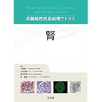 肺 (非腫瘍性疾患病理アトラス) | 蛇澤 晶, 熊坂利夫 |本 | 通販 | Amazon