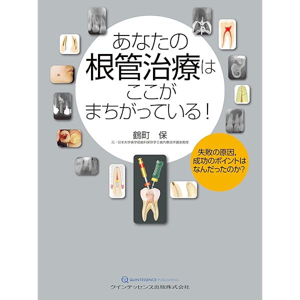 完全解説 根管治療トラブル攻略本: エンドのよくある24の難局面大攻略