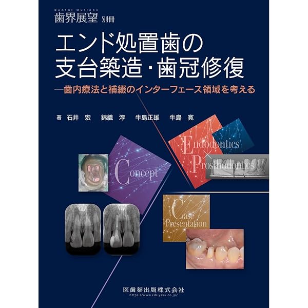 治る歯髄 治らない歯髄 ハイライトQ&A91: 臨床で悩むギモンにDr.泉が