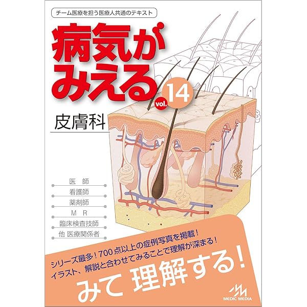 病気がみえる vol.12 眼科 第1版 | 医療情報科学研究所 |本 | 通販