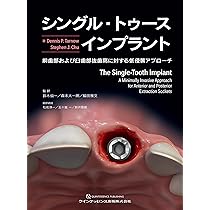 シングル・トゥースインプラント: 前歯部および臼歯部抜歯窩に対する低