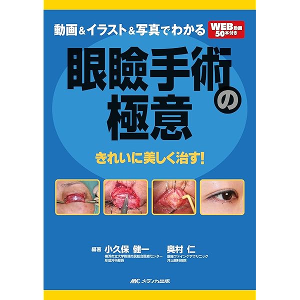 Amazon.co.jp: 眼科スゴ技 眼瞼手術: WEB動画付き厳選35本付き/解剖が
