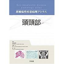 肝臓を診る医師のための肝臓病理テキスト(改訂第2版) | 中沼安二