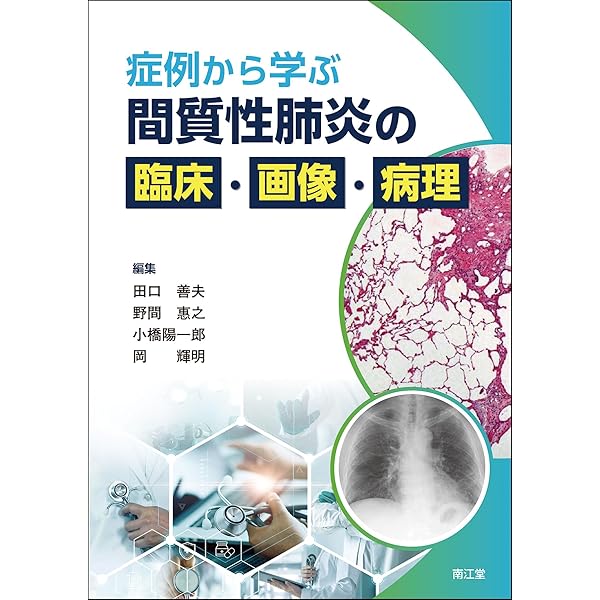 Amazon.co.jp: 間質性肺疾患診療マニュアル 改訂第2版 : 久保 惠嗣