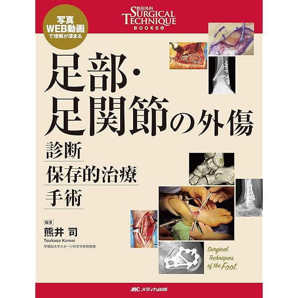 Amazon.co.jp: 我々の足の外科（手術手技アトラス） : 田中康仁, 谷口