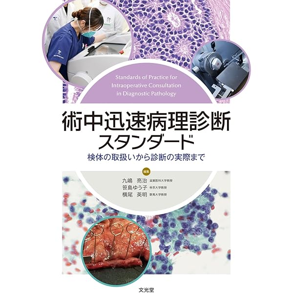 Amazon.co.jp: 細胞診鑑別アトラス : 金城 満: 本