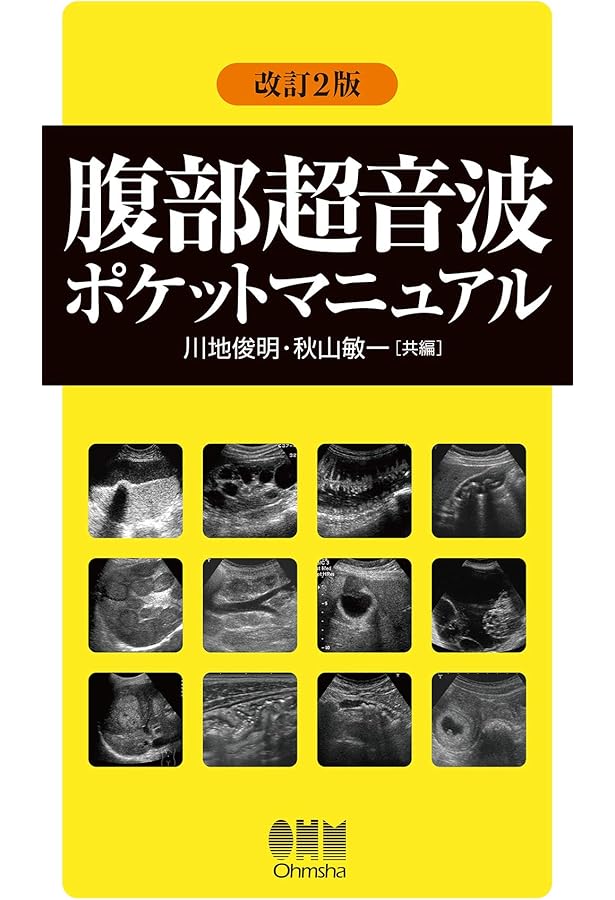 腹部超音波テキスト〜上・下腹部〜 改訂第三版 (Atlas Series超音波編