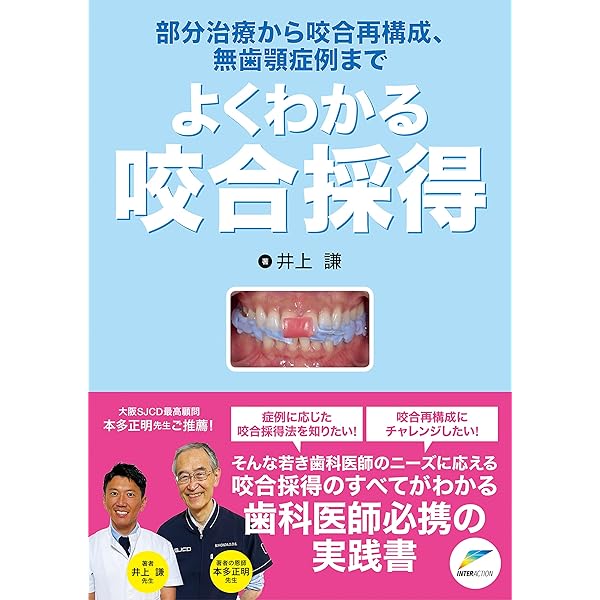 新版 臨床咬合補綴治療 | 今井 俊広, 今井 真弓 |本 | 通販 | Amazon