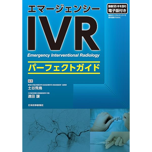 肝動脈化学塞栓療法(TACE): 理論と実践ストラテジー | 松井 修 |本