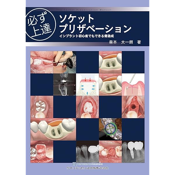 ゼロから見直す歯周外科治療 | 松延 允資 |本 | 通販 | Amazon