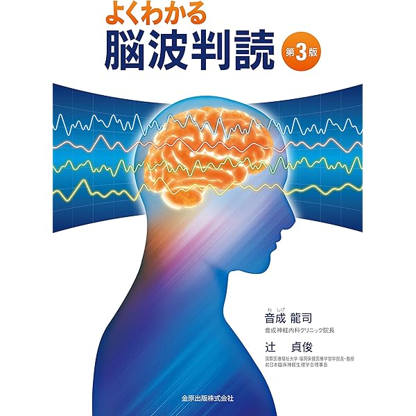 臨床脳波学 第6版 | 大熊 輝雄 |本 | 通販 | Amazon