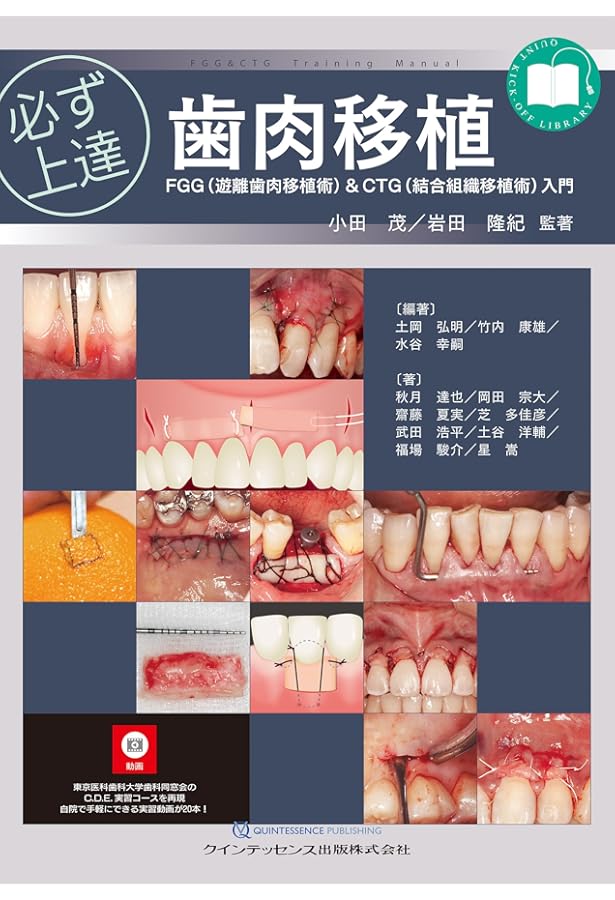 裁断済】イラストレイテッド歯冠修復アドバンステクニック