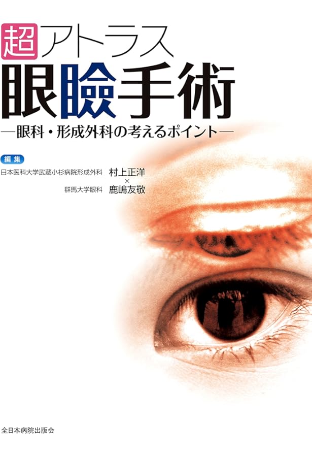 Amazon.co.jp: 眼形成手術: 眼瞼から涙器まで (眼科臨床エキスパート