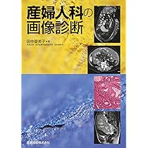 産婦人科の画像診断 | 田中優美子 |本 | 通販 | Amazon