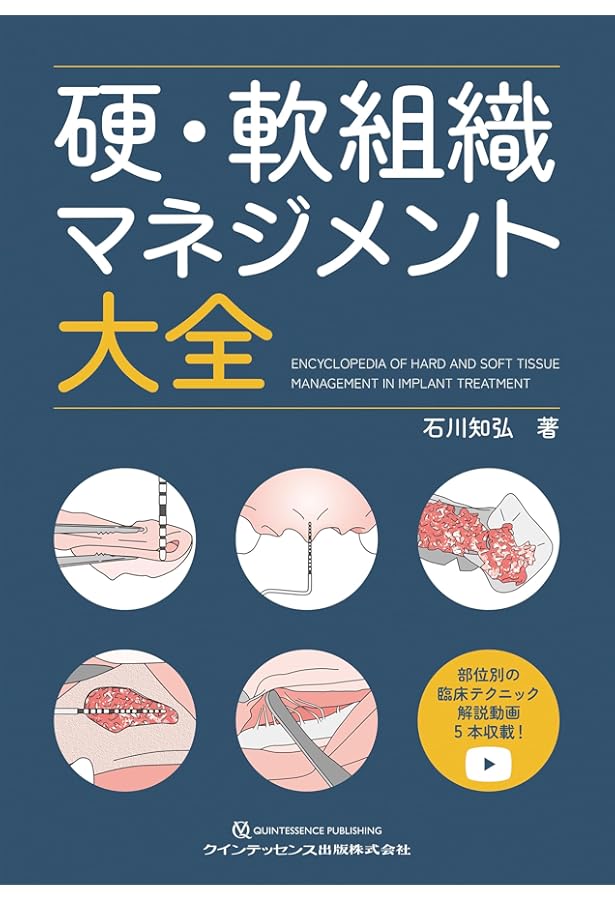 即時治療の真髄: 補綴的要件を達成するための即時埋入と即時負荷