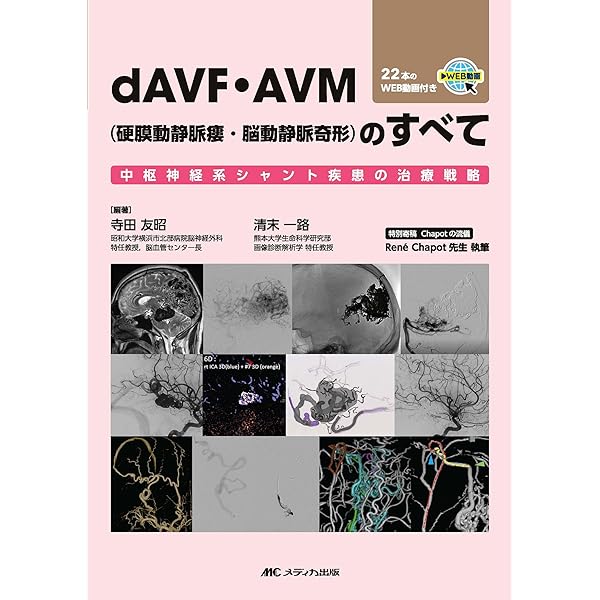 改訂2版 脳脊髄血管撮影 超実践マニュアル: セッティングと撮影のコツ