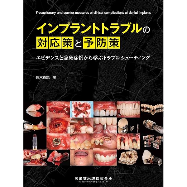 歯周・インプラント治療における再生療法 | 船登 彰芳, 片山 明彦, 南