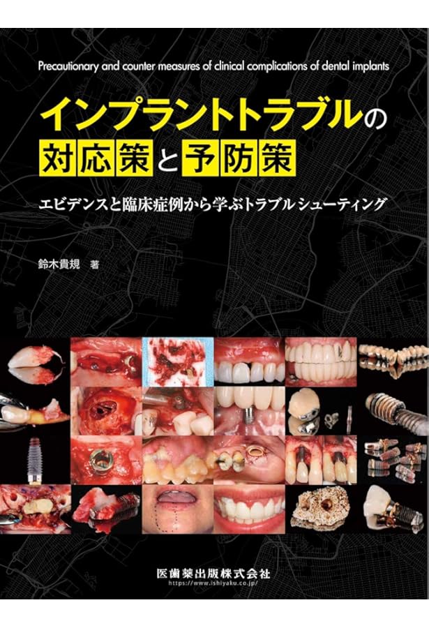 改訂版 インプラント外科: 動画で理解! 基本手技と自家骨移植の
