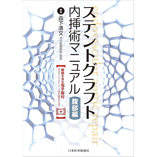 ステントグラフト内挿術マニュアル 胸部編 ─ 動画を含む電子版付