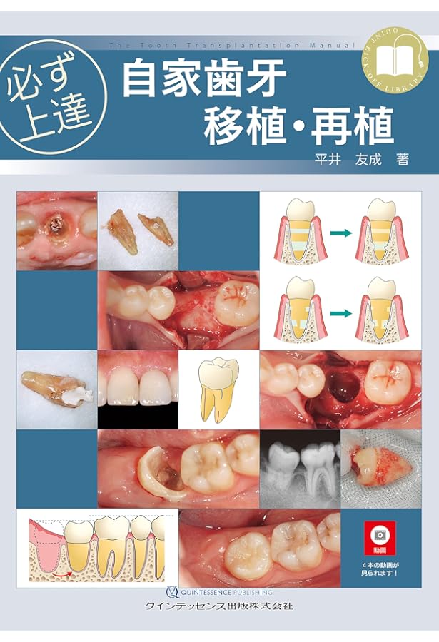 自家歯牙移植 増補新版 (シリーズ MIに基づく歯科臨床) | 月星 光博