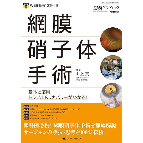 どう診て どう治す? 網膜剥離 | 平形 明人, 井上 真 |本 | 通販 | Amazon