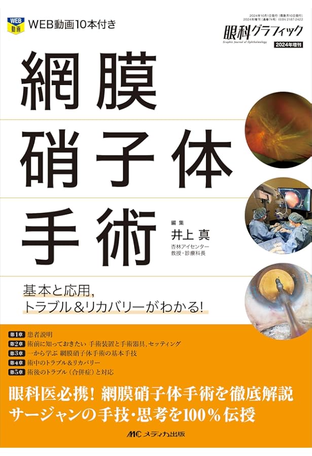 Amazon.co.jp: 網膜硝子体手術SOS―トラブルとその対策 : RETINA