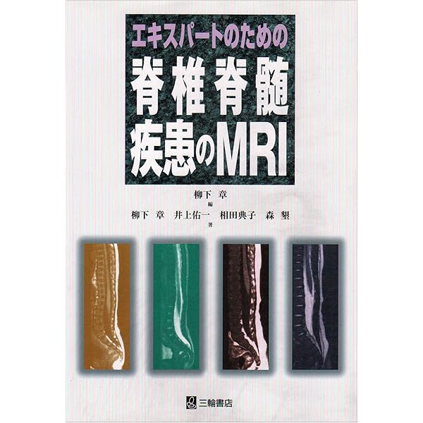 エキスパートのための脊椎脊髄疾患のMRI 第2版 | 柳下 章 |本 | 通販