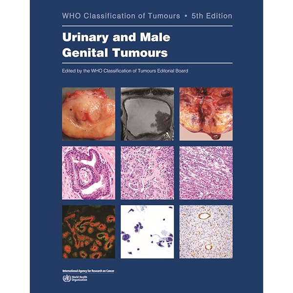Breast Tumours: WHO Classification of Tumours (Medicine