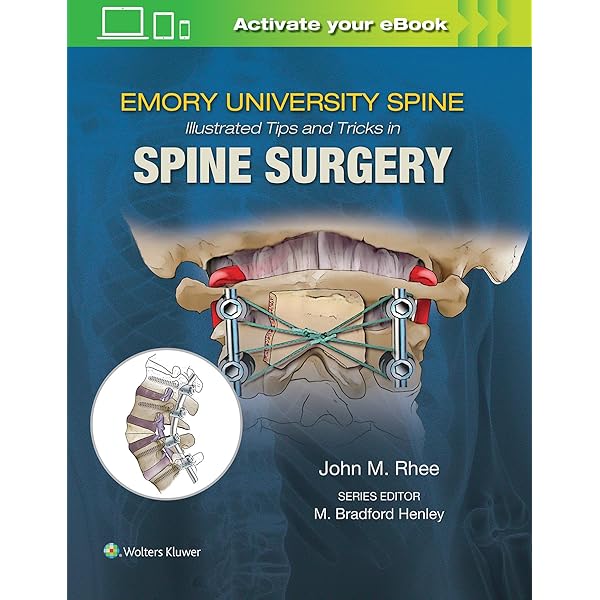 Spine Surgery: Tricks of the Trade: 9781604068962: Medicine