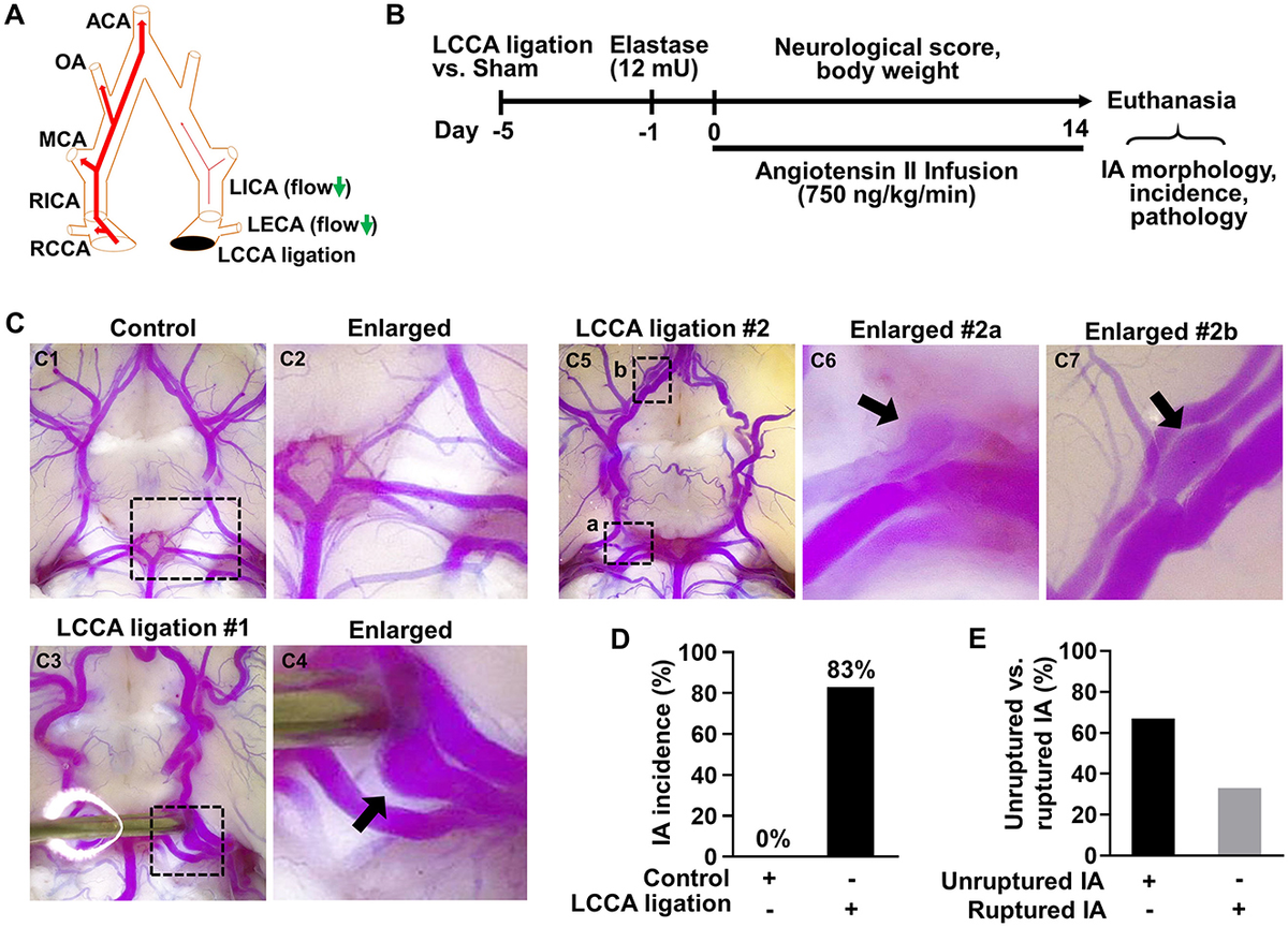 Frontiers | High wall shear stress-dependent podosome formation in