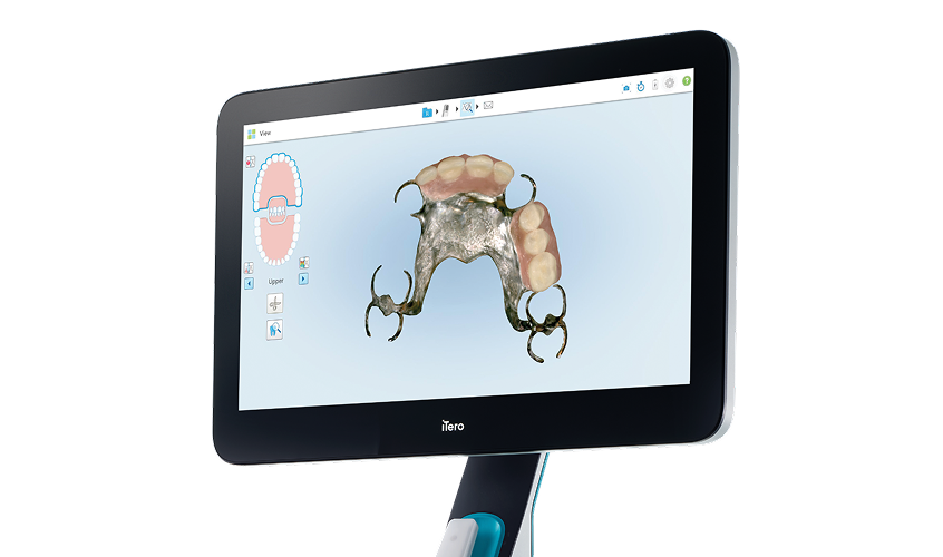 iTero Lumina | 製品概要 | インビザライン・ジャパン