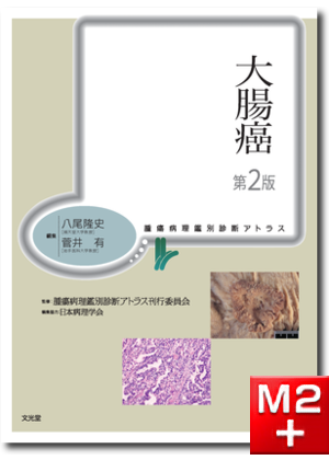 m3電子書籍 | 腫瘍病理鑑別診断アトラス 大腸癌 第2版