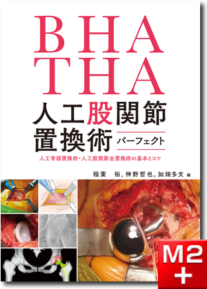m3電子書籍 | TKA・UKA 人工膝関節置換術パーフェクト～人工膝関節全