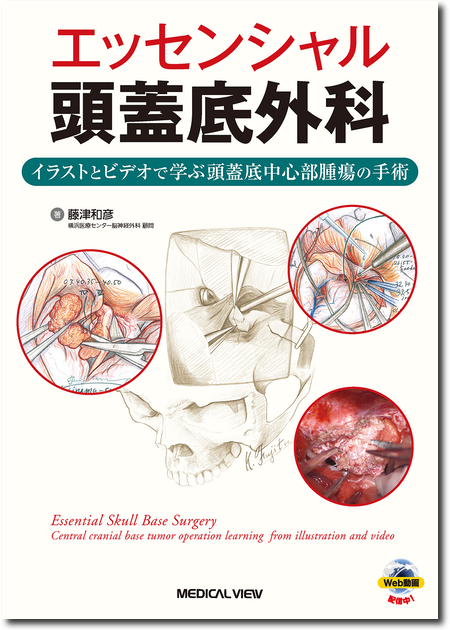 m3電子書籍 | エッセンシャル頭蓋底外科［Web動画付］