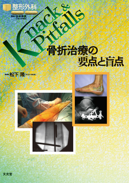 m3電子書籍 | 整形外科 Knack & Pitfalls 肘関節外科の要点と盲点