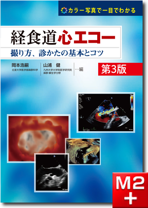 m3電子書籍 | カラー写真で一目でわかる 経食道心エコー 第3版