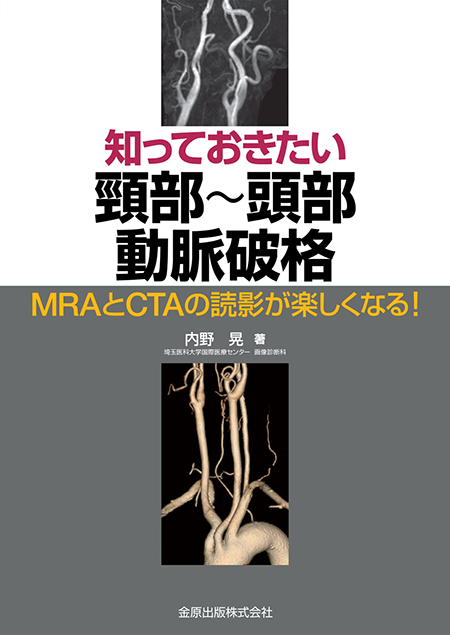 m3電子書籍 | パーフェクトマスター 頚動脈狭窄症