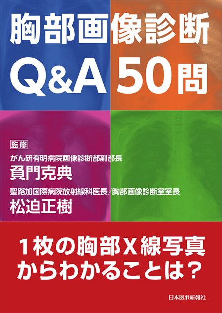 m3電子書籍 | 第1種放射線取扱主任者試験 重要問題集中トレーニング