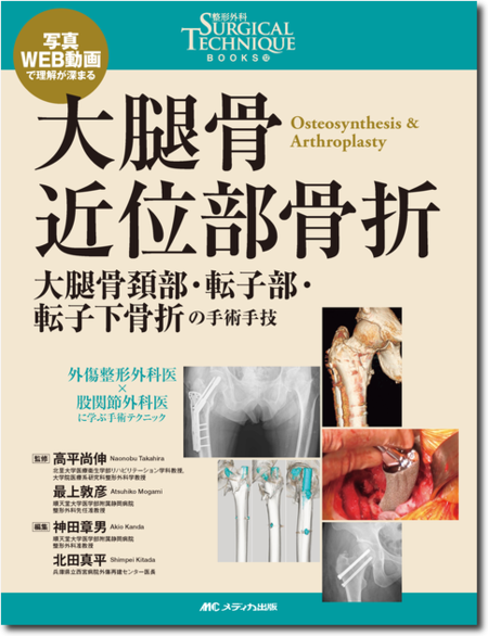 m3電子書籍 | 整形外科Surgical Technique BOOKS12 大腿骨近位部骨折