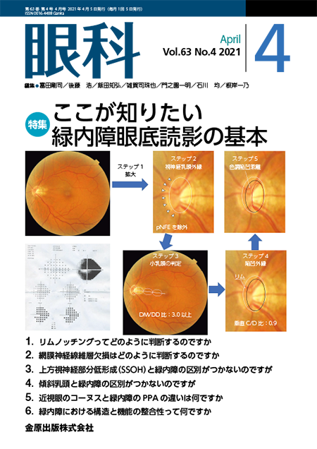 m3電子書籍 | 眼疾患アトラスシリーズ 第1巻 前眼部アトラス