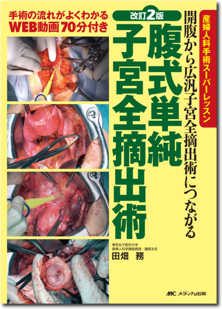 m3電子書籍 | 産婦人科手術スーパーレッスン 改訂2版 腹式単純子宮全