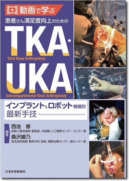 m3電子書籍 | 整形外科SURGICAL TECHNIQUE BOOKS 14 膝の外傷 診断
