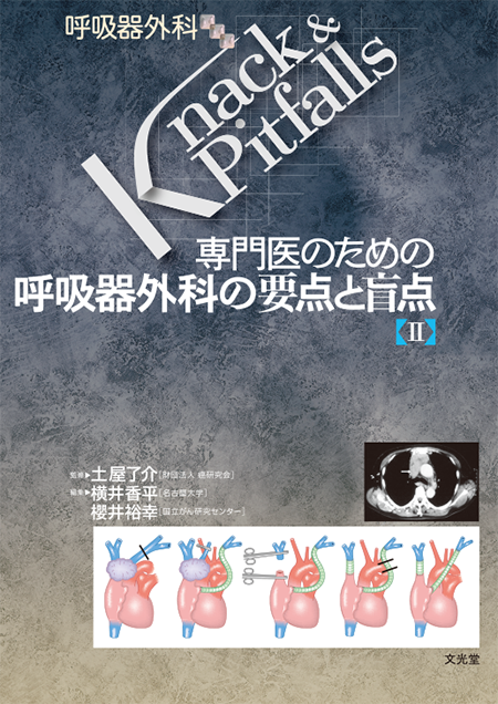 m3電子書籍 | 整形外科 Knack & Pitfalls 肩関節外科の要点と盲点