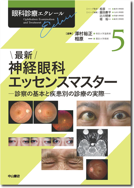 m3電子書籍 | 複視診療のストラテジー チームで実現する患者中心の