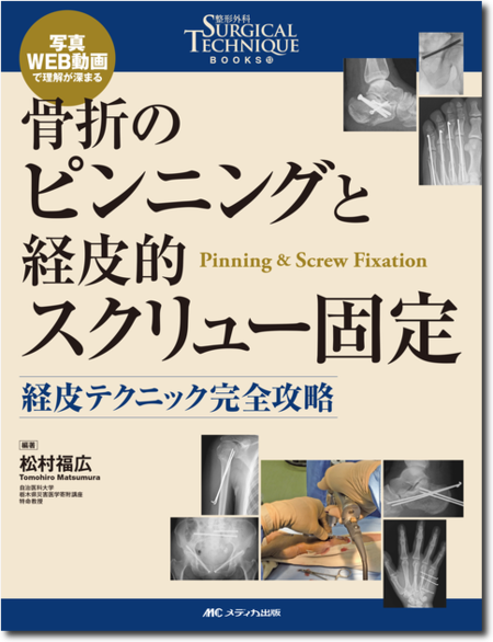 m3電子書籍 | 整形外科 Surgical Technique BOOKS11 肘の外傷［動画付き］