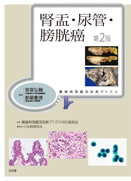 m3電子書籍 | 腫瘍病理鑑別診断アトラス 大腸癌 第2版