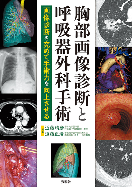 m3電子書籍 | 呼吸器外科単孔式手術マニュアル