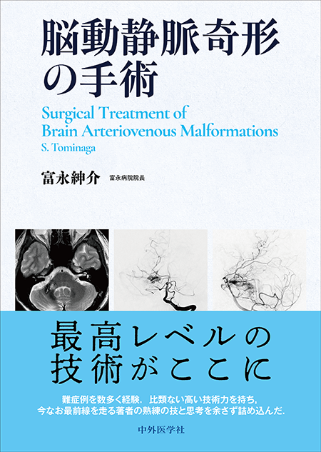 m3電子書籍 | プライム脳神経外科 3 脳・脊髄動静脈奇形と頭蓋内・脊髄